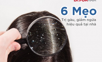 6 Mẹo Trị Gàu Ngứa Đầu Hiệu Quả Tại Nhà